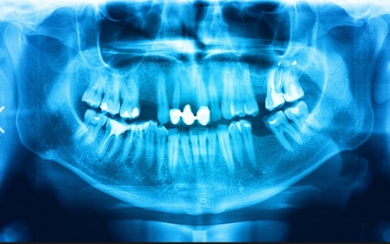 banner Radiographie panoramique dentaire